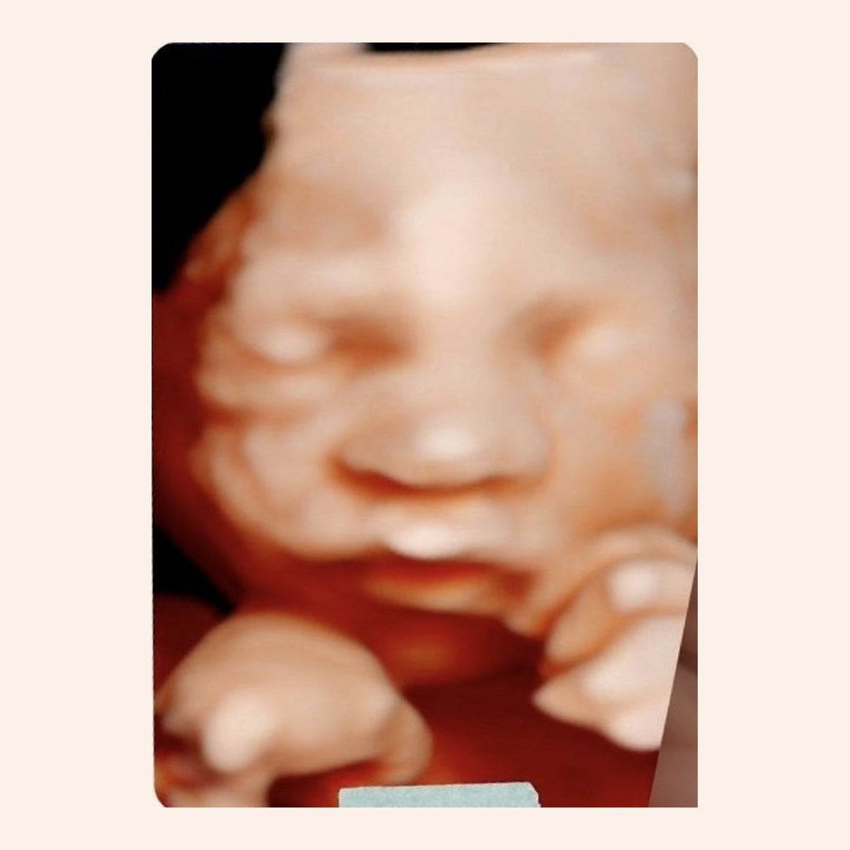 Sessão Mini | Imagem digital pré-natal Bloom